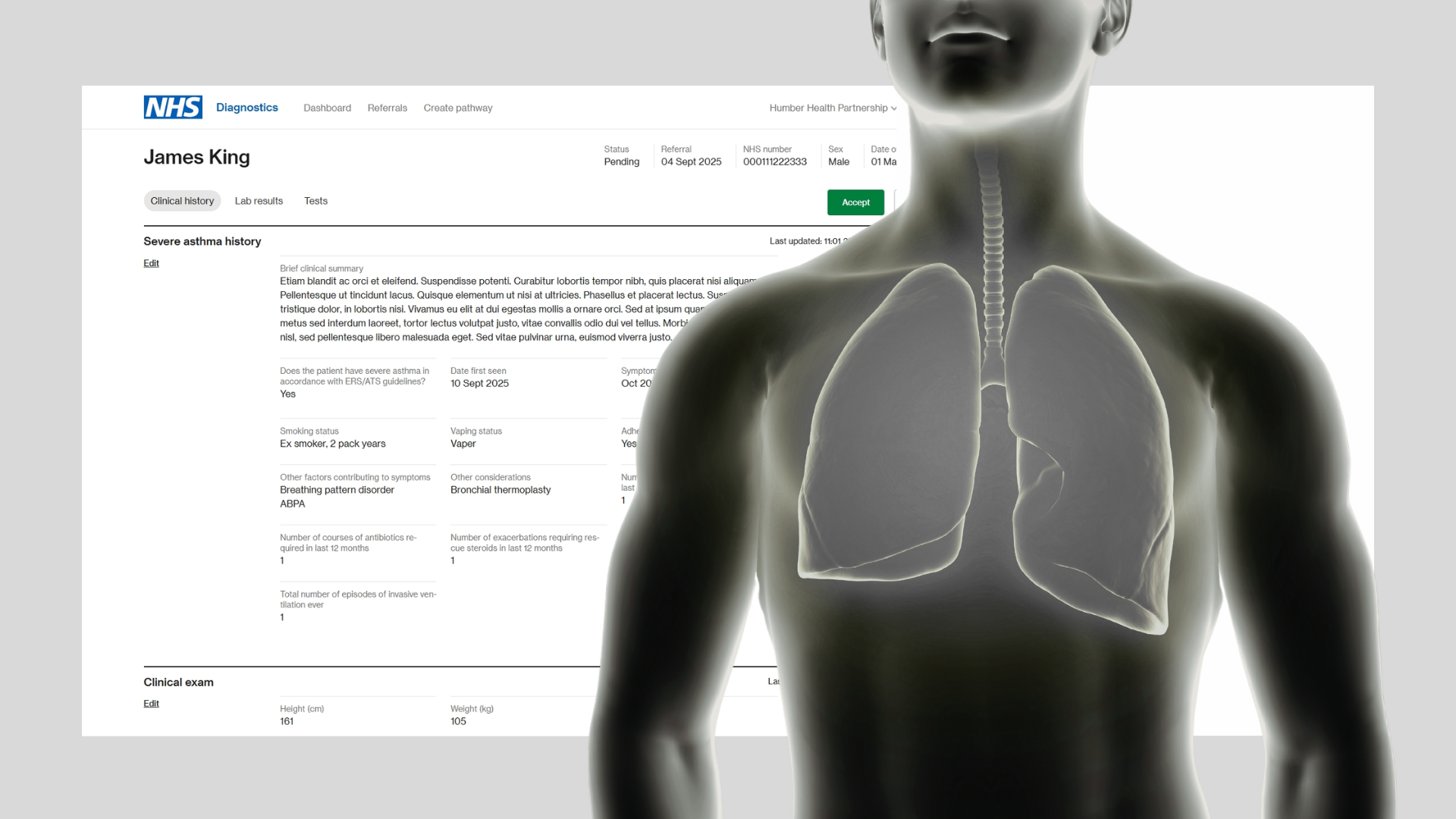Illustration of human lungs with a computer interface in the background.